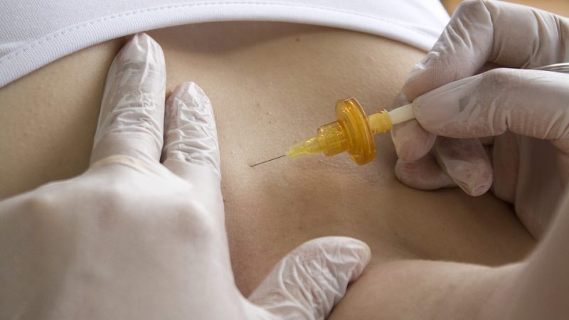 Fizjoterapia – najkorzystniejszy sposób na problemy zdrowotne.